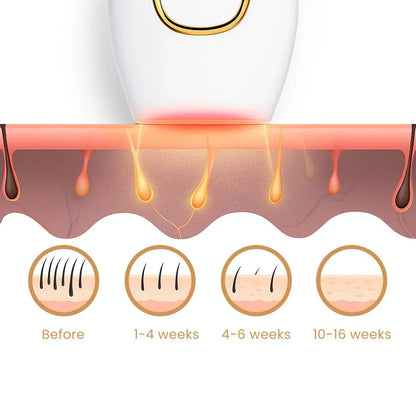 IPL Laser Hair removal