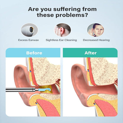 Ear wax Removal Kit with Camera